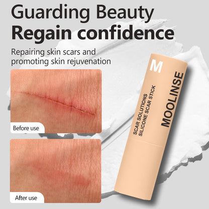 Scar Removal - Care Stick Nourishing And Gentle Skin Care